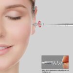 6 Pcs Ear Cleaner Spoon, Curette & Spiral Ear Cleaning Tools - Image 5